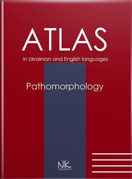 Патоморфологія (Pathomorphology) : атлас Боднар Я. Я., Багрій М. М., Зербіно Д. Д.